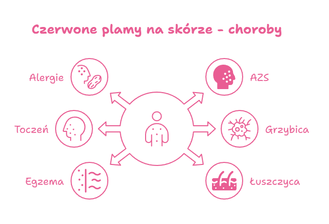 czerwone plamy na ciele